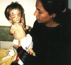 Child and mother Child with depleted uranium Birth Defects